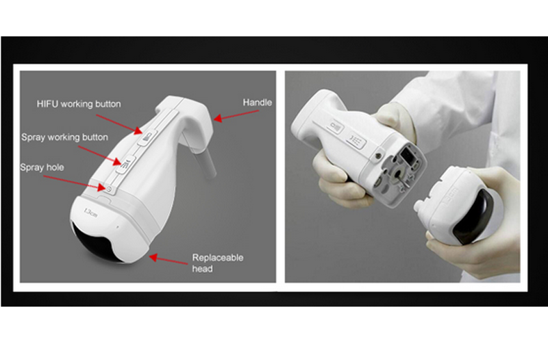 HIFU LIPOSONIC