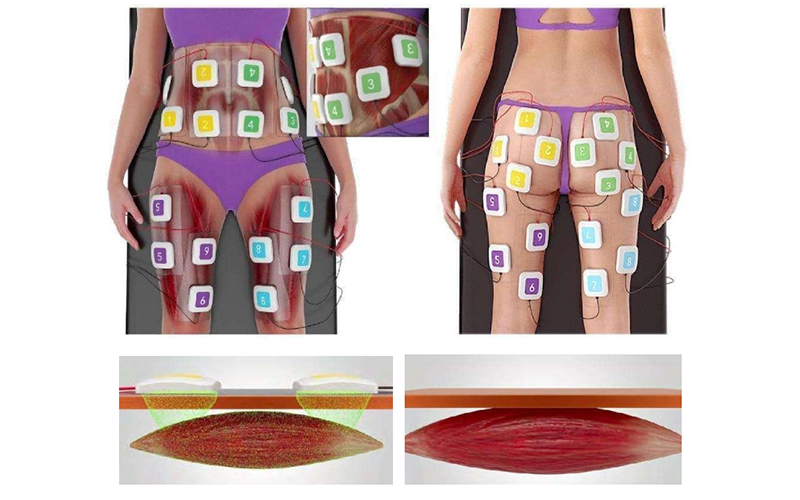 Vertical true ID+EMS body slimming machine