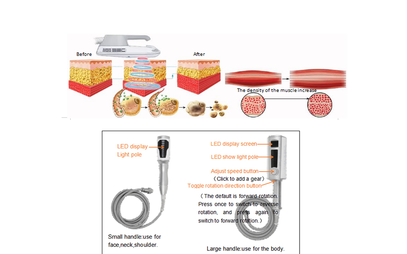 Portable two in one microvibration inner balls roller and emslim RF