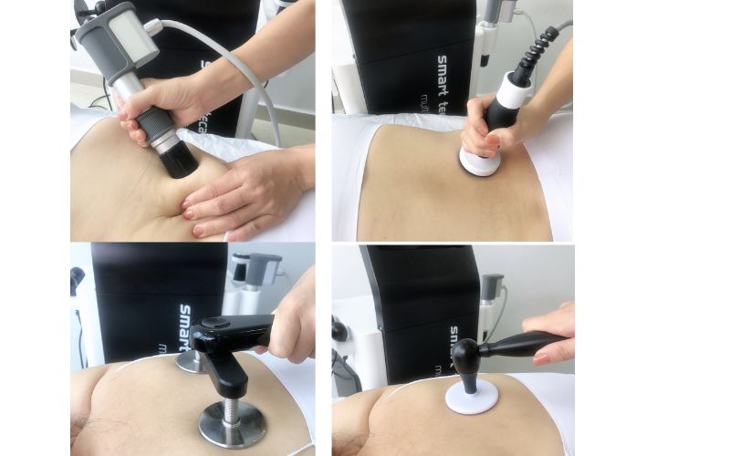 3 in 1 smart tecar shockwave ultrasound