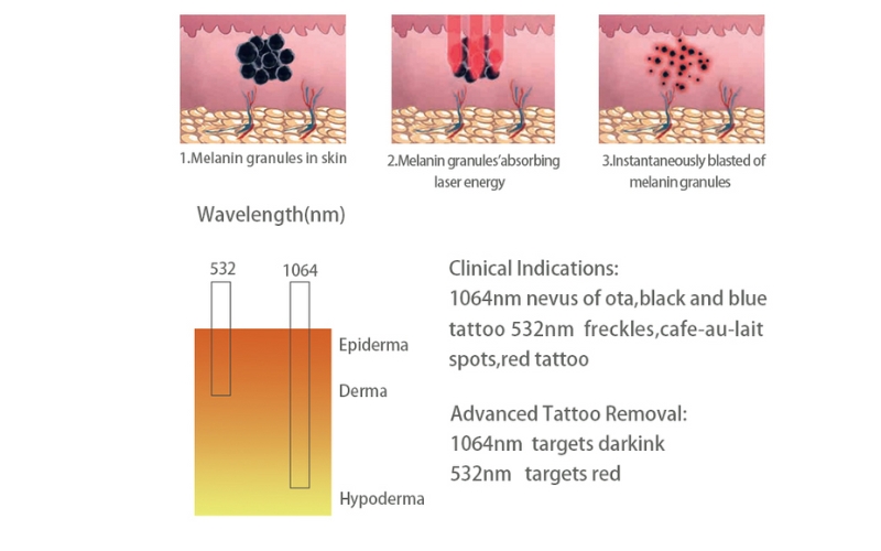 2025 Gomecy Pico Laser Air Cooling Q Switch Nd Yag Laser All Colors Tattoo Removal Machine