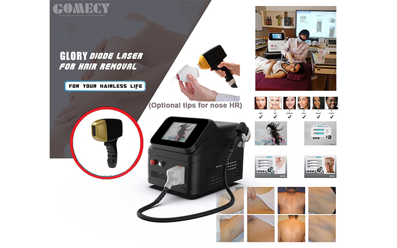 Portable diode laser hair removal machine